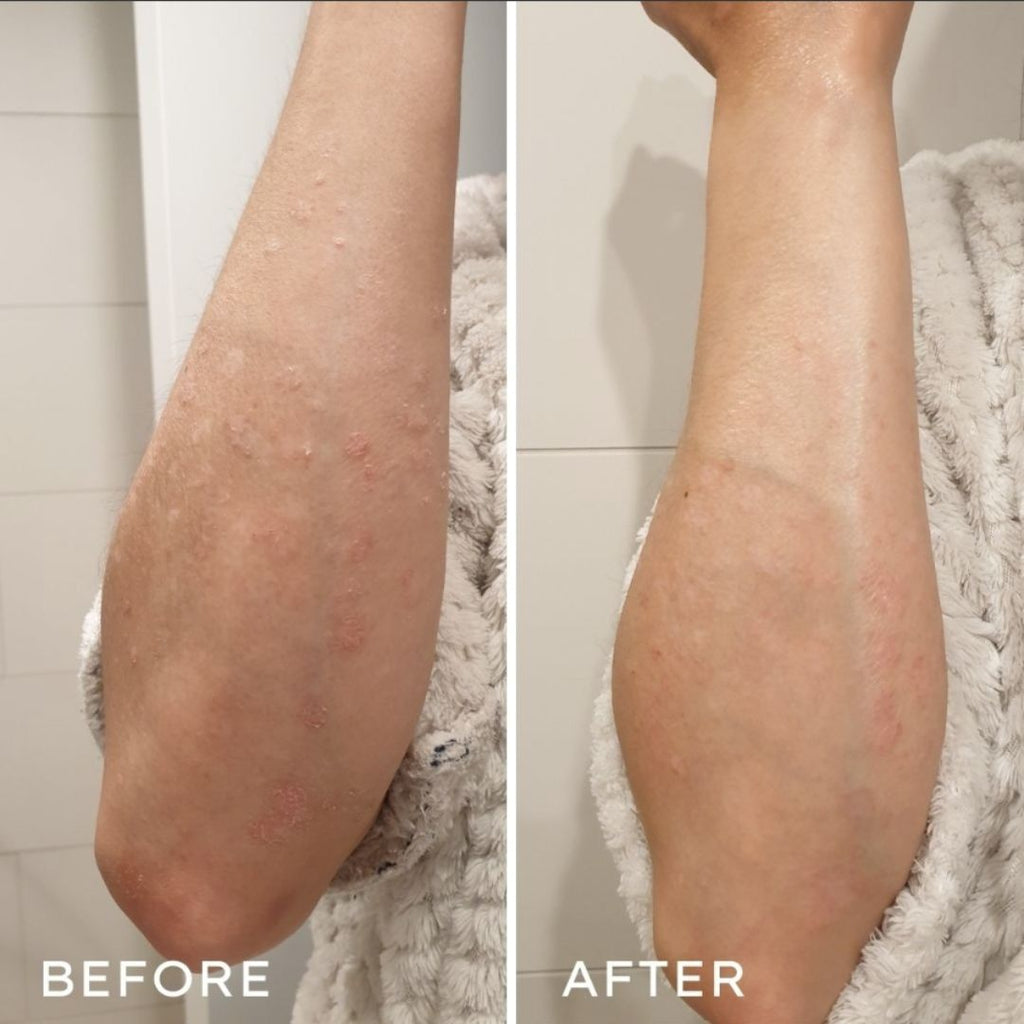 Before and after results showing hydrated skin using Boracay Skin Natural Sun and Body Oil